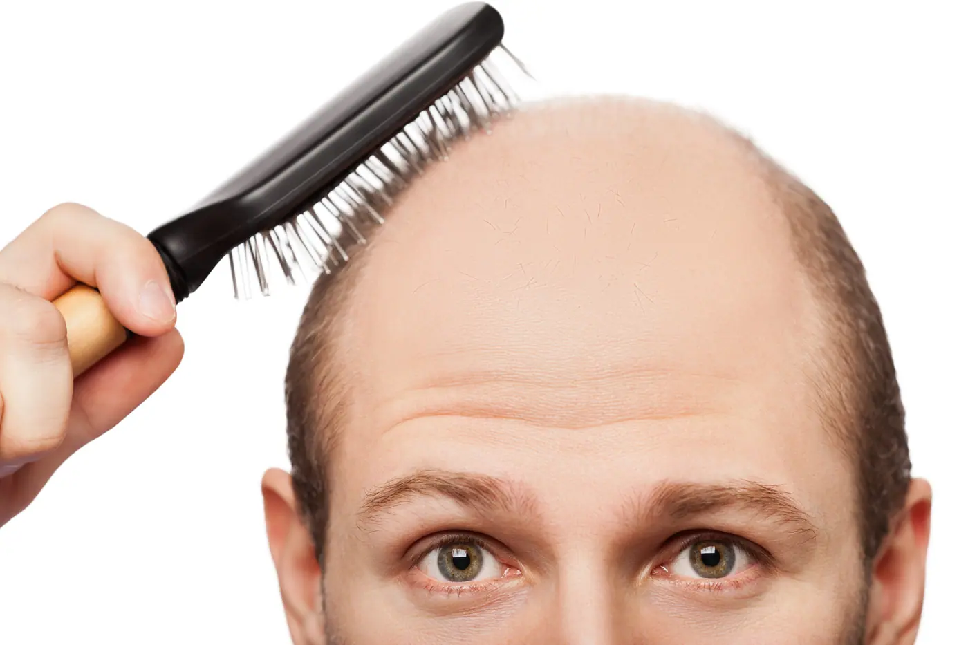 Chute de cheveux et soin du cuir chevelu