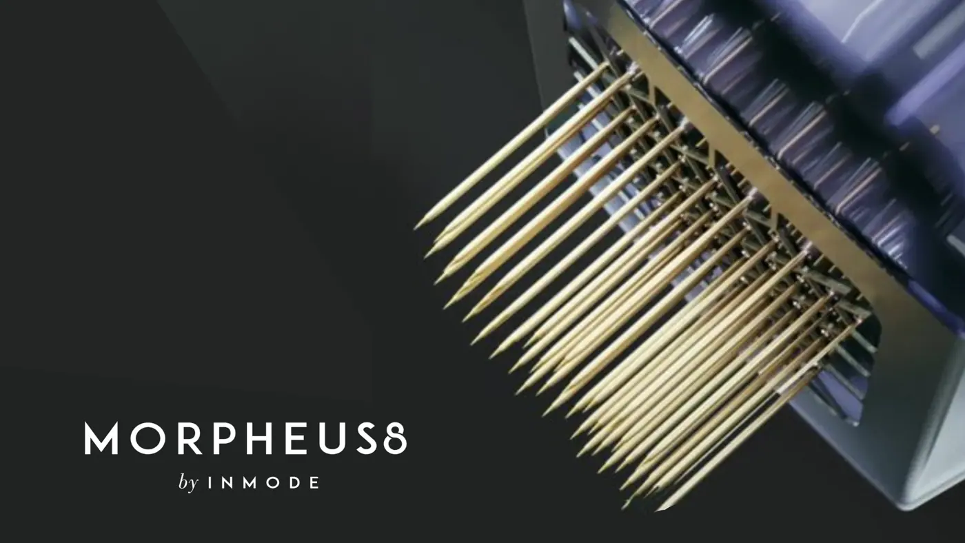 Morpheus-8-Nice