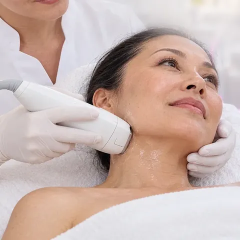 HIFU Genius — visage complet et cou — Centre Esthétique EstheMed à Nice