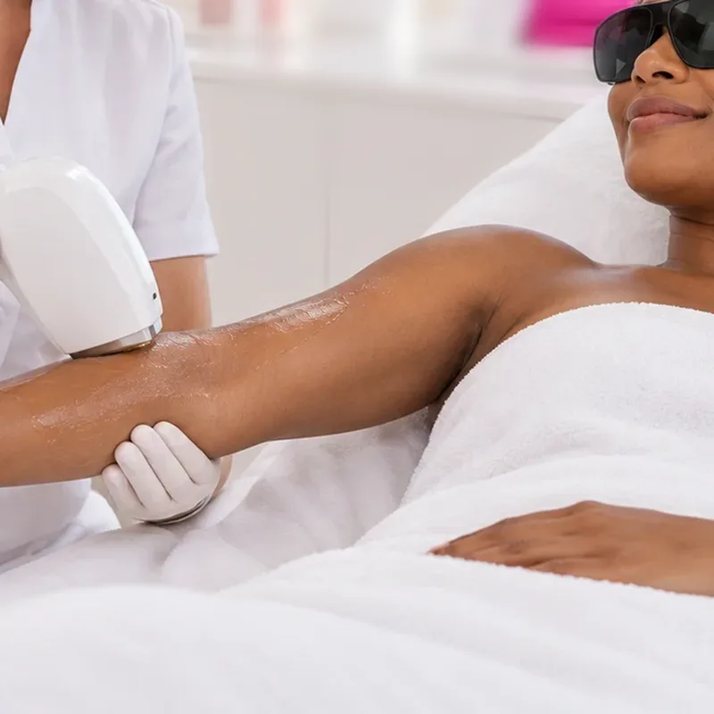 Épilation laser des bras — Centre Esthétique EstheMed à Nice