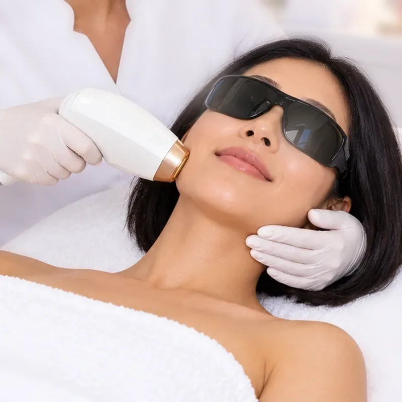 Épilation laser du visage entier — Centre Esthétique EstheMed à Nice