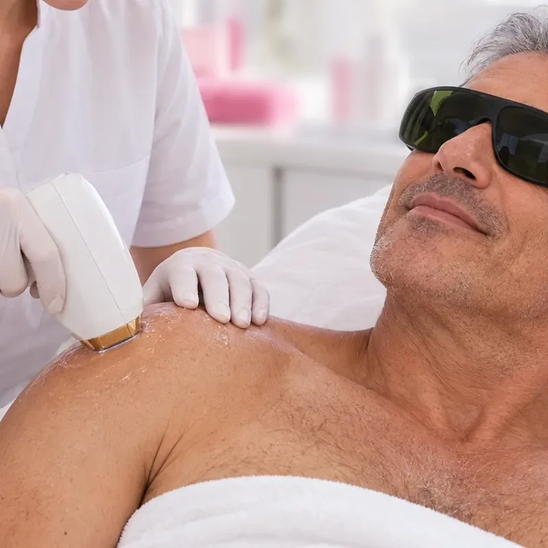 Épilation laser des épaules — Centre Esthétique EstheMed à Nice