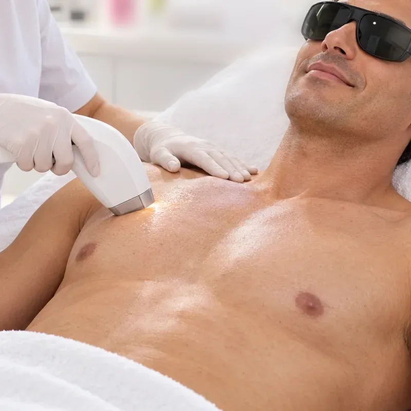 Épilation laser du torse — Centre Esthétique EstheMed à Nice