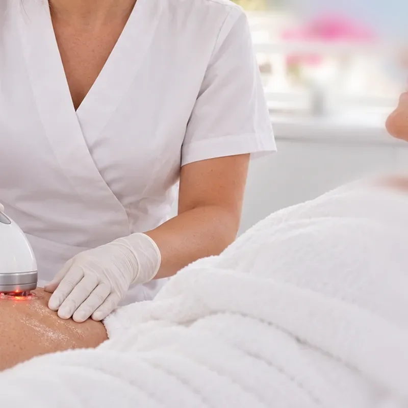 Radiofréquence anti-cellulite sur la cuisse — Centre Esthétique EstheMed à Nice